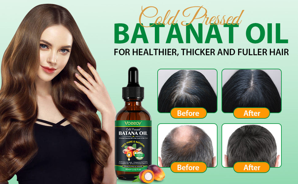 Batana Oil Original – Crecimiento Rápido del Cabello, Repara Caída y Cabello Dañado